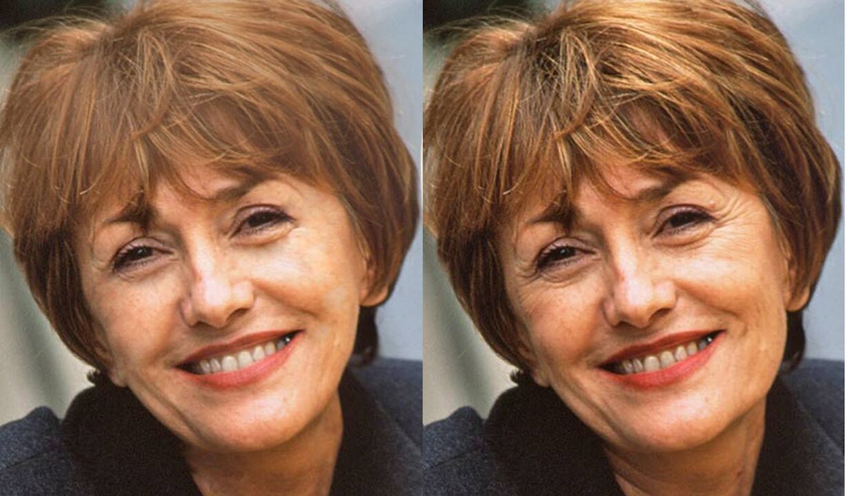 foto näost enne ja pärast kontuurimist